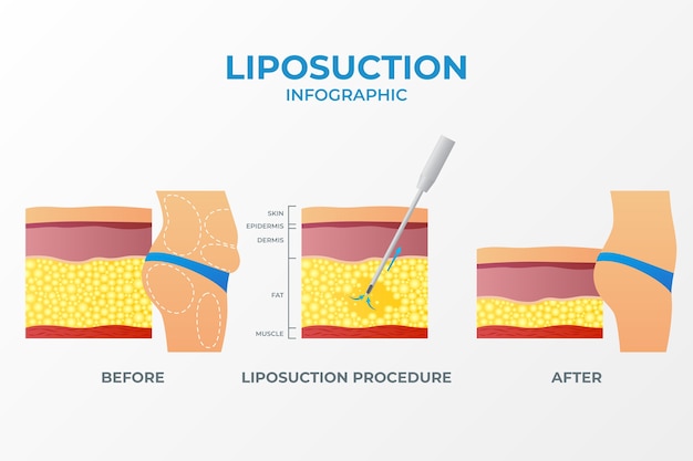 Diagram showing visceral fat releasing inflammatory signals