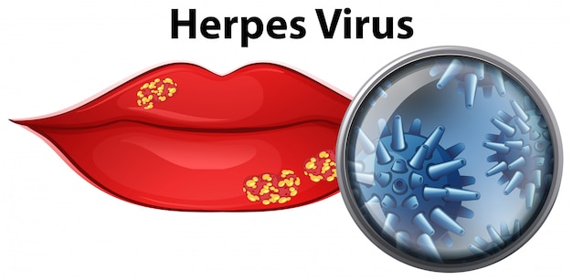 Breakthrough Nanobody Targets Herpes Virus Before It Infects Cells — A New Era in Antiviral Therapy