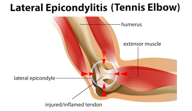 Diagram of knee joint structure