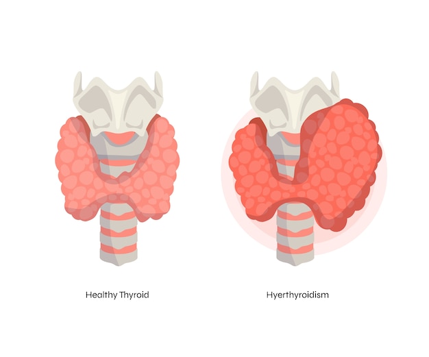 Thyroid gland and hormone regulation